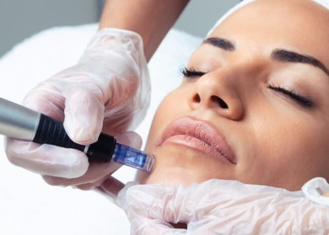 Facial Rejuvenecimiento Exosomas con Dermapen - Imagen 1