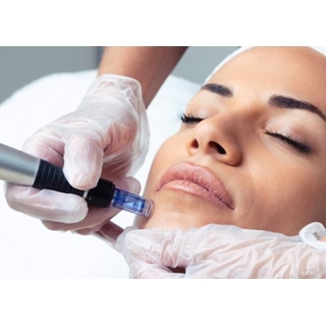 OFERTA hasta 24 de Febrero Facial Rejuvenecimiento Exosomas con Dermapen - Imagen 1