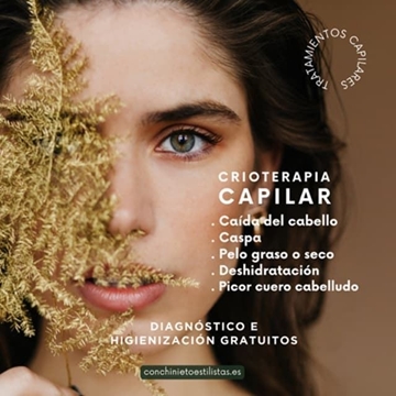 Recuperación Capilar Dermatitis Seborrea Crioterapia Capilar - Imagen 1