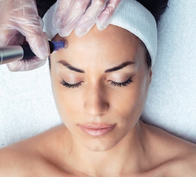 Rejuvenecimiento Facial con Exosomas - Imagen 1